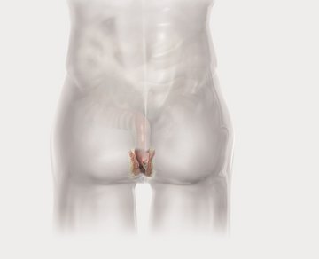 biolitec_KV_Proctology_LQ